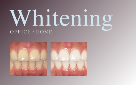 Whitening OFFICE / HOME